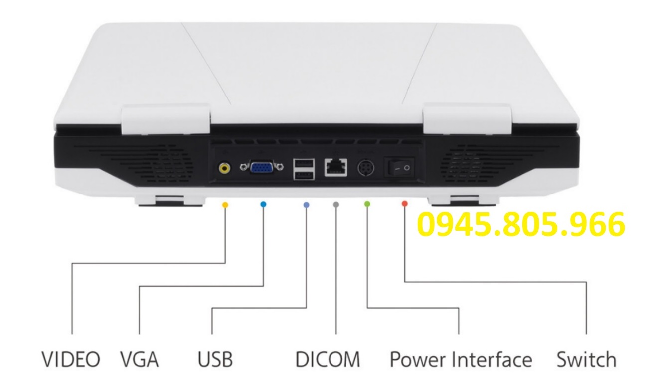 Máy siêu âm xách tay Ruiseng RS-N50. Màn hình 15 inch